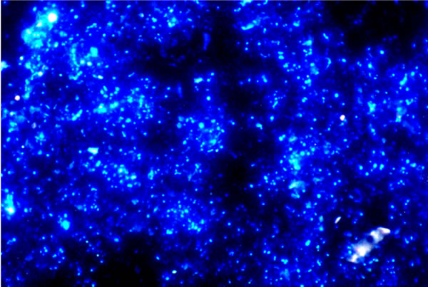 Fluorescence micrograph of soil micro-organisms