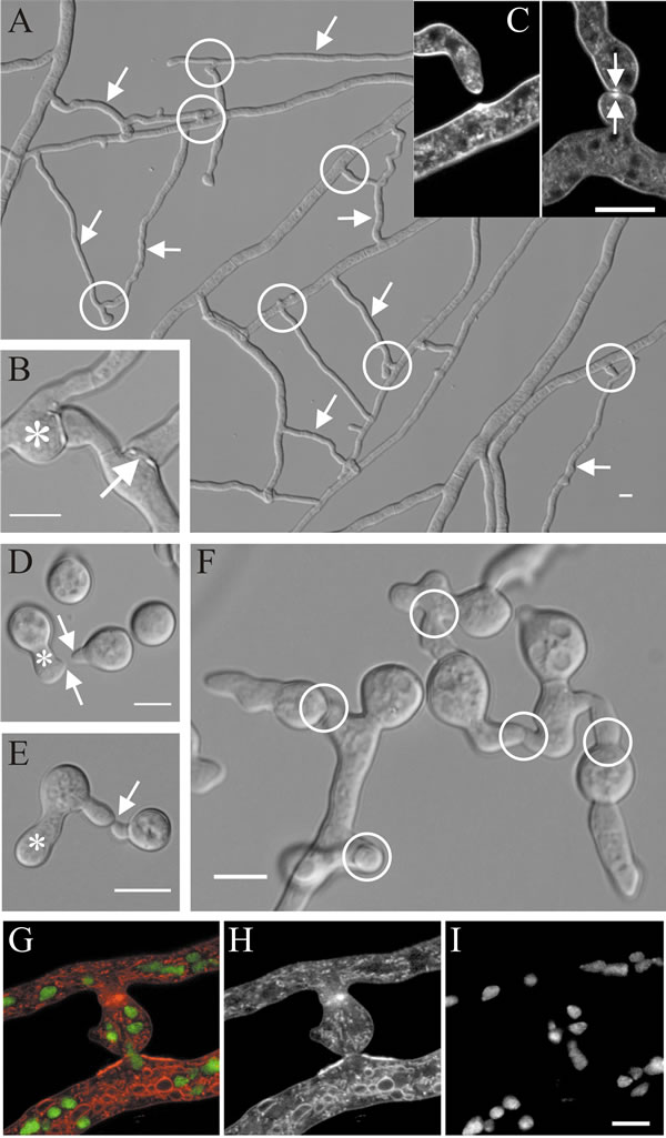 Hyphal fusions in Neurospora crassa