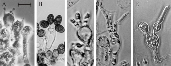 Basidium development of Coprinopsis cinerea is disrupted by application of ammonium salts