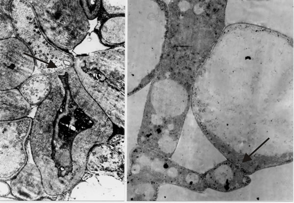 Differentiation across the dolipore septum