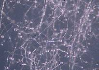 Micrograph of a fungal mycelium